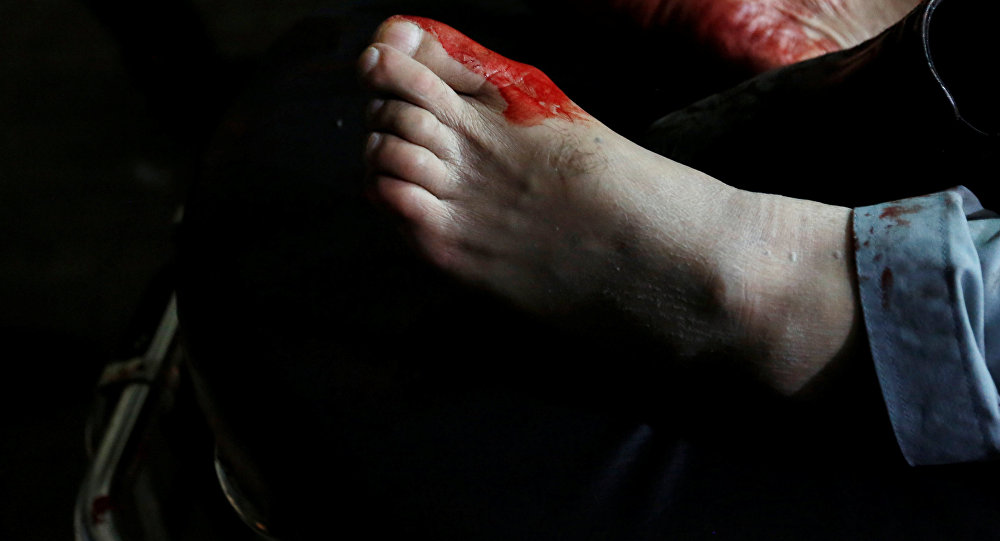 Ноги раненого мужчины. Архивное фото