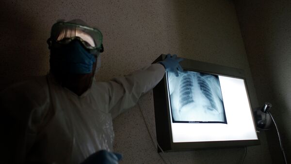 Медициналык кызматкер бейтаптын өпкөсүнүн рентгенин көргөзүп жатат. Архив - Sputnik Кыргызстан