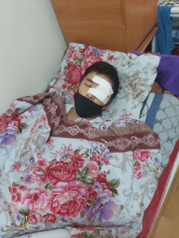 Митингде бир көзүнөн айрылган Уларбектин таежеси: экинчи көзү да коркунучта Митингде бир көзүнөн айрылган Уларбектин таежеси: экинчи көзү да коркунучта - Sputnik Кыргызстан