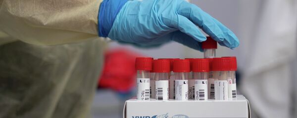 Медицина кызматкери пробиркаларды даярдап турат - Sputnik Кыргызстан