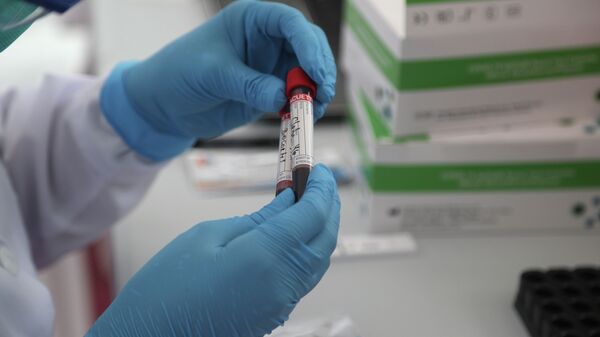 Кан анализи - Sputnik Кыргызстан