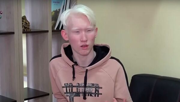 Казахстанец-альбинос покоряет соцсети — видео - Sputnik Кыргызстан