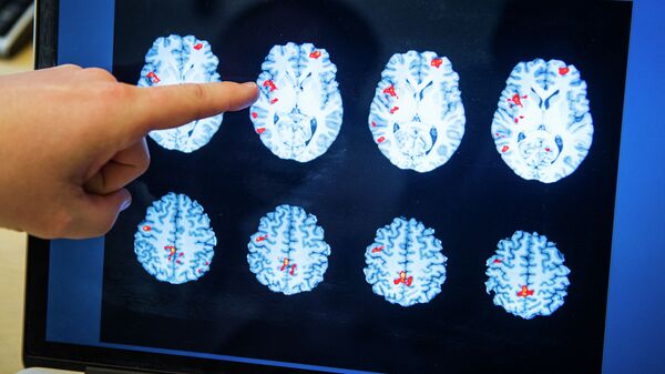Врач указывает на активность мозга пациента в больнице. Архивное фото - Sputnik Кыргызстан