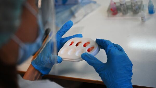 Медицинский сотрудник проводит экспресс-тест крови пациентов, переболевших COVID-19. Архивное фото - Sputnik Кыргызстан