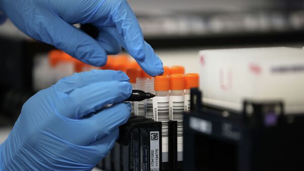 Сотрудник лаборатории собирает анализы на коронавирус. Архивное фото - Sputnik Кыргызстан