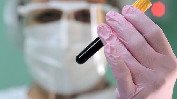 Медсестра держит пробирку после забора крови на антитела к коронавирусу COVID-19. Архивное фото - Sputnik Кыргызстан