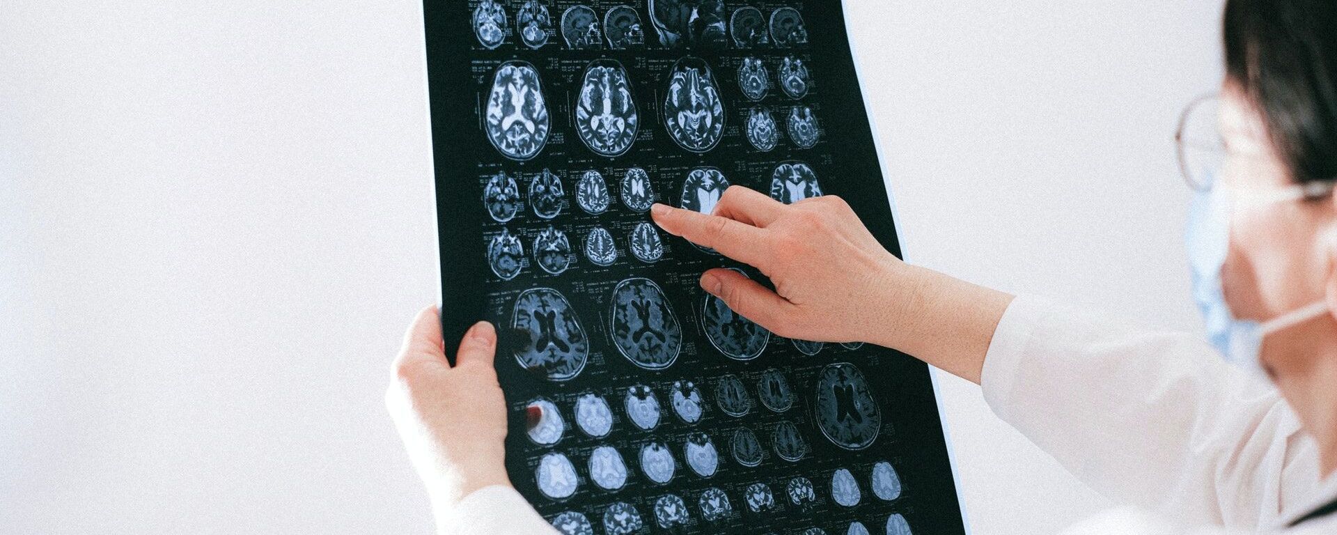 Врач изучает рентген снимок мозга пациента. Иллюстративное фото - Sputnik Кыргызстан, 1920, 23.02.2022
