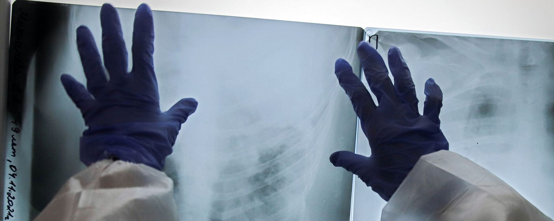 Медик смотрит рентгеновский снимок легких пациента в отделении для больных коронавирусом. Архивное фото - Sputnik Кыргызстан, 1920, 05.01.2022