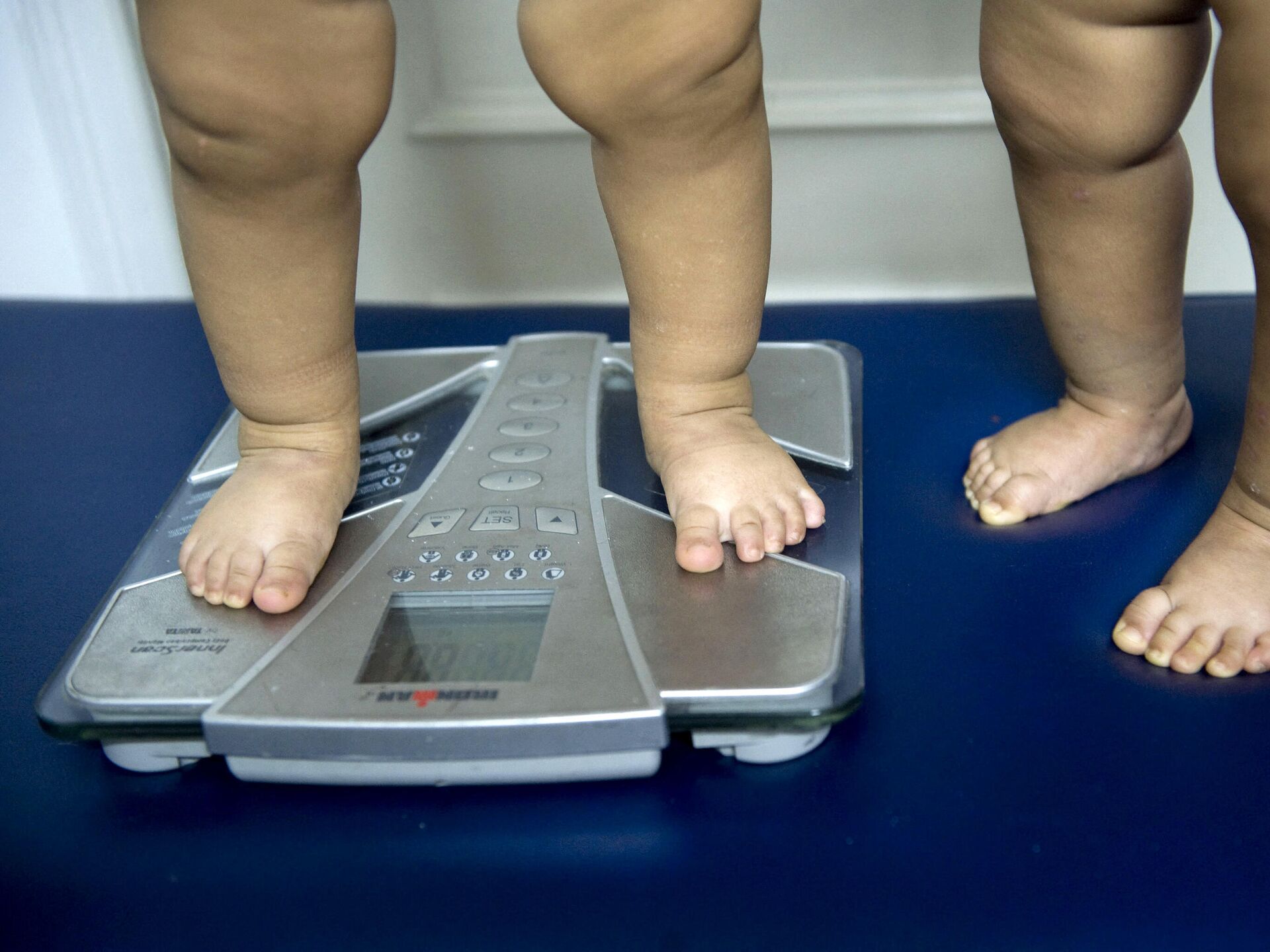 Увеличение массы тела ребенка. Лишний вес у детей. Избыточный вес у детей. Диагностика ожирения.