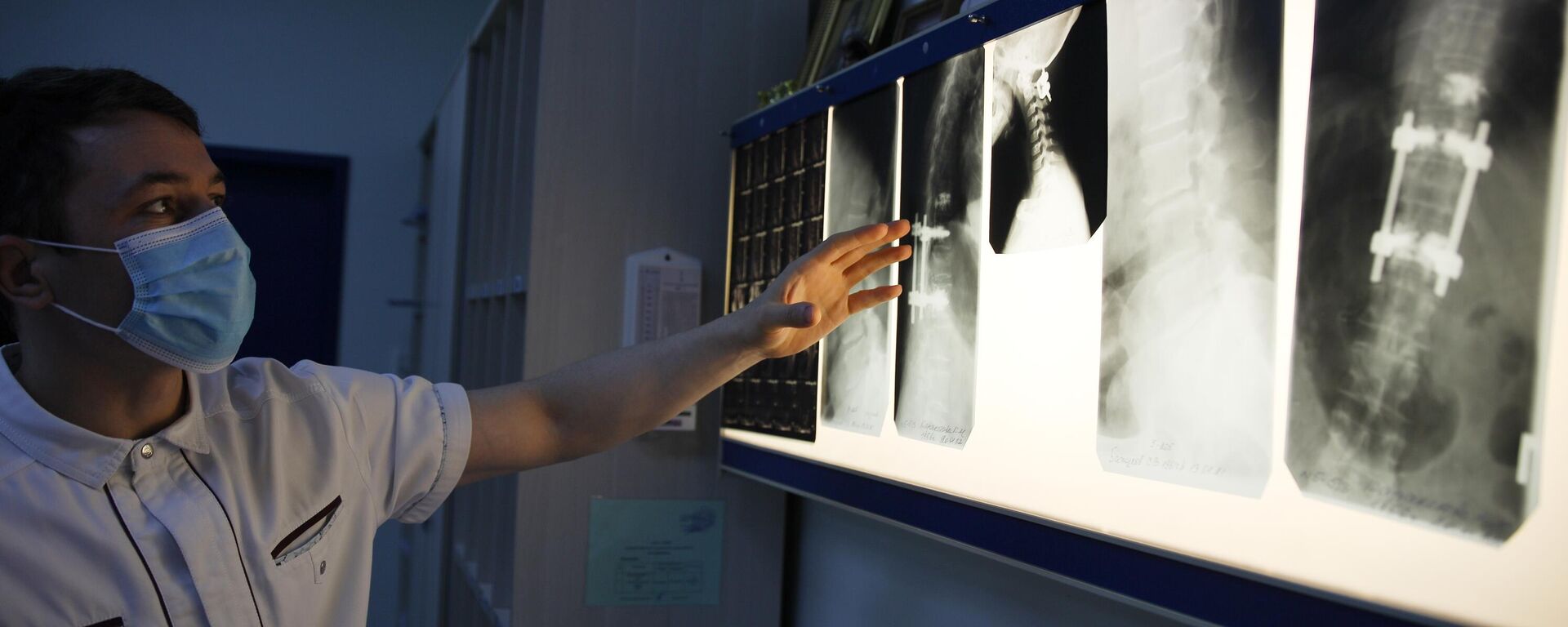Врач изучает рентген снимки пациента. Архивное фото - Sputnik Кыргызстан, 1920, 10.03.2023