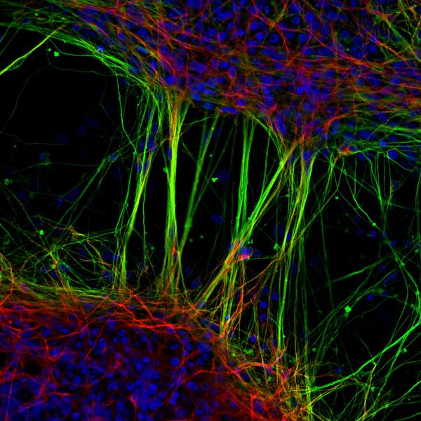 Снимок человеческих нейронов, полученных из нервных стволовых клеток. Работа доктора Цзяньцзюня Гао и профессора Гленда из Университета Сиднея заняла 7-е место. - Sputnik Кыргызстан