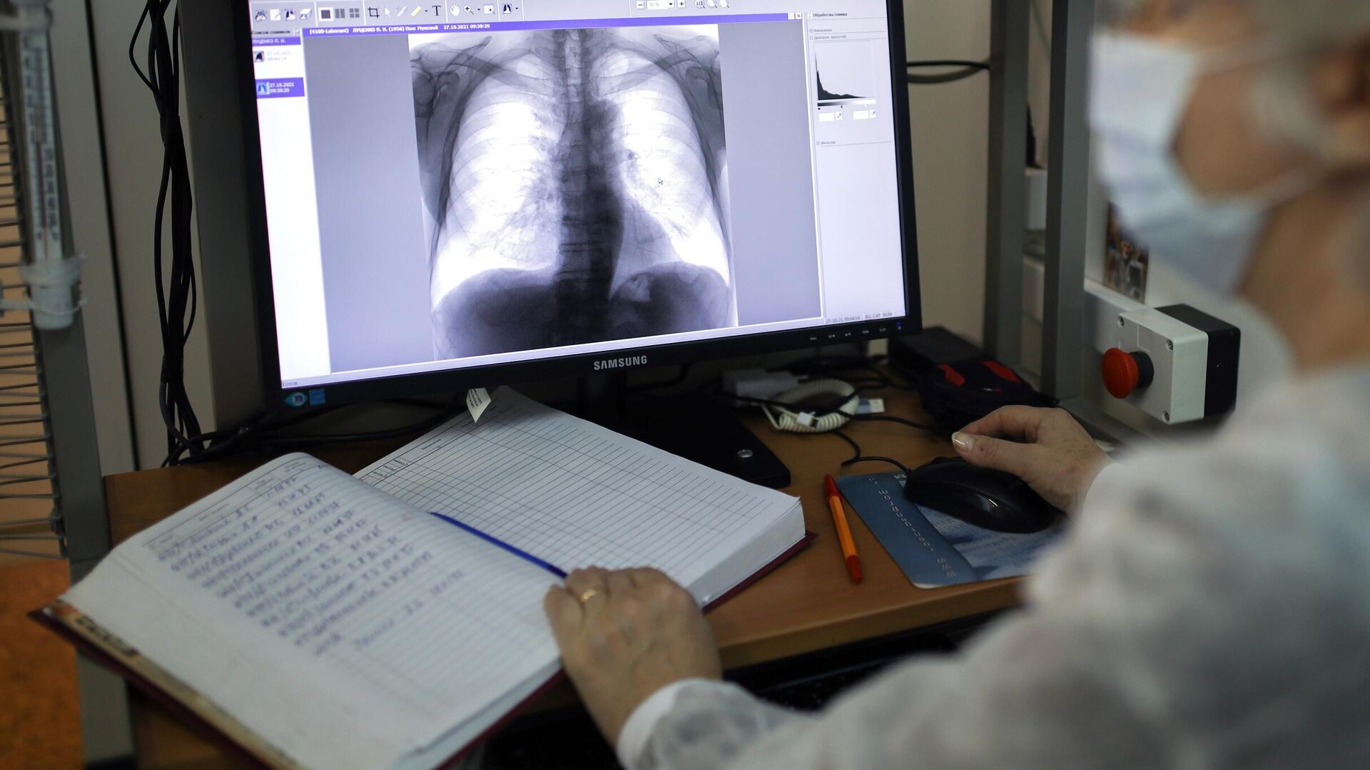 Врач-рентгенолог смотрит рентген снимок пациента. Архивное фото - Sputnik Кыргызстан, 1920, 21.01.2023