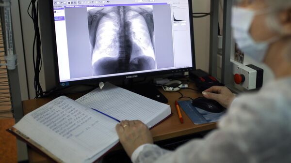 Врач-рентгенолог смотрит рентген снимок пациента. Архивное фото - Sputnik Кыргызстан