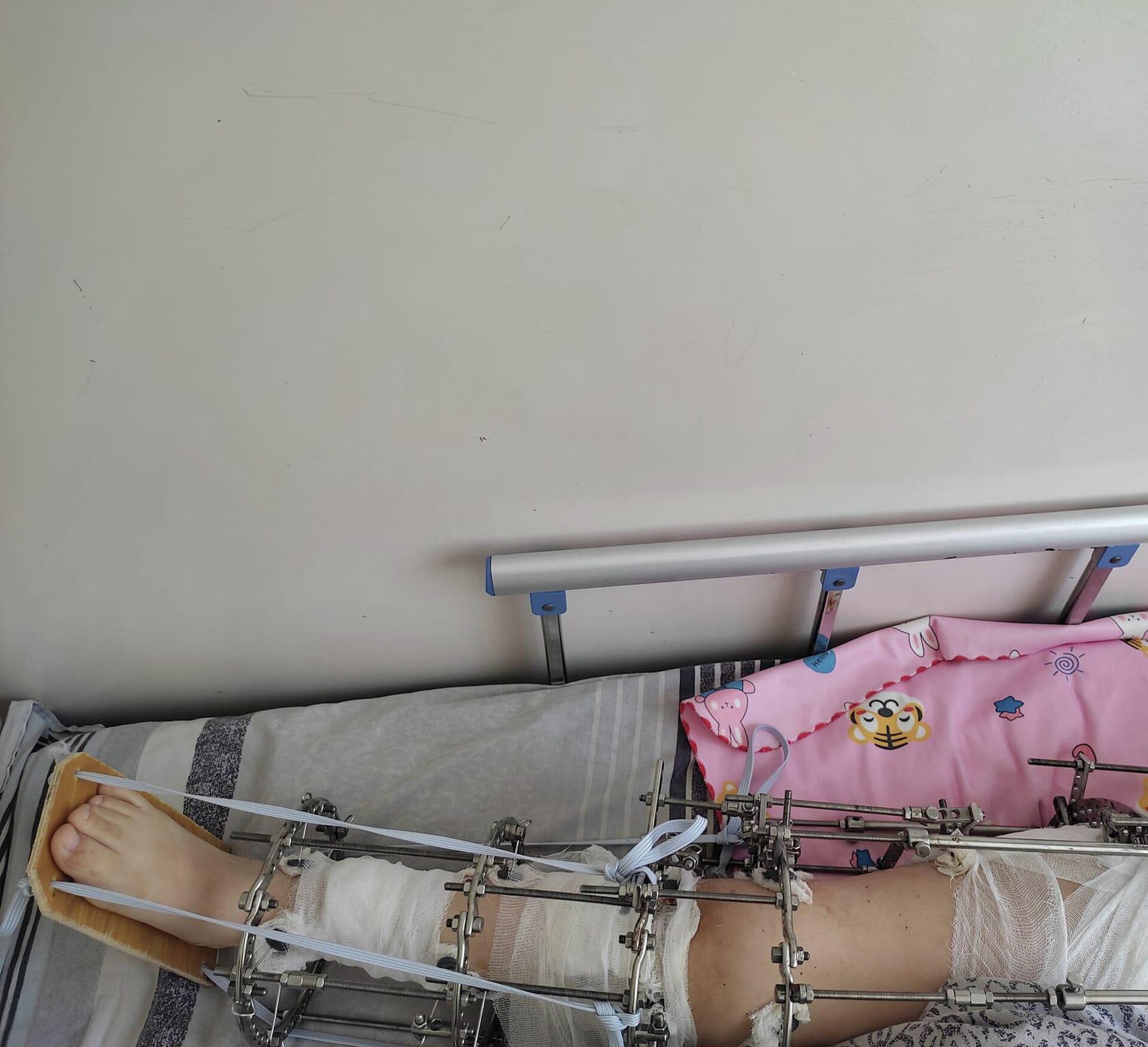 Операция на малом тазу девочке-подростку в Оше - Sputnik Кыргызстан, 1920, 13.08.2023