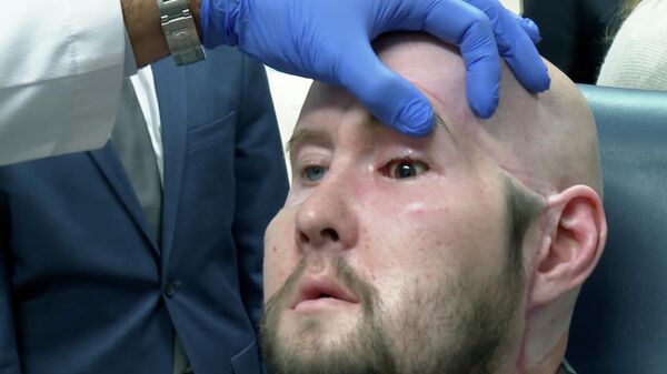 Дүйнөдө биринчи жолу көздүн өзү толугу менен алмаштырылды - Sputnik Кыргызстан