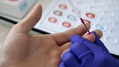 Сдача крови донорами в ДНР