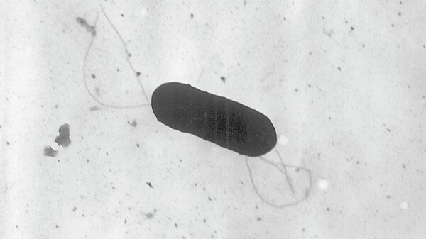 Бактериальная инфекция листериоз. Архивное фото - Sputnik Кыргызстан