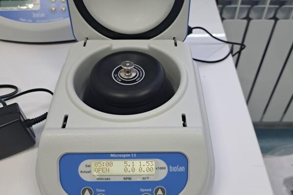 В Кыргызстане на базе Национального центра охраны материнства и детства впервые внедряется методология иммунологического тестирования при пересадке почки - Sputnik Кыргызстан