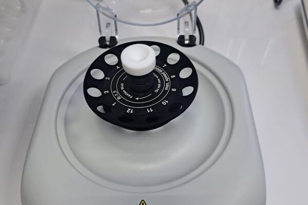 Обследование помогает определить совместимость донора и реципиента (получателя), провести перекрестный тест для выявления возможной реакции антител, а также рассчитать показатель уровня чувствительности пациента - Sputnik Кыргызстан