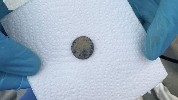 Плоская батарейка, которую проглотила девочка в Бишкеке - Sputnik Кыргызстан