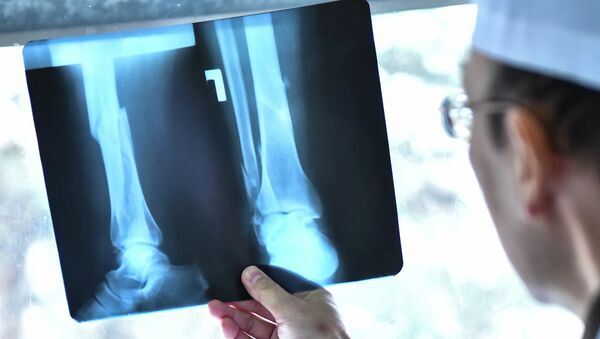 Доктор рассматривает рентген снимок. Архивное фото - Sputnik Кыргызстан