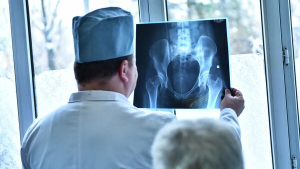Врач смотрит на рентген снимок пациента. Архивное фото - Sputnik Кыргызстан
