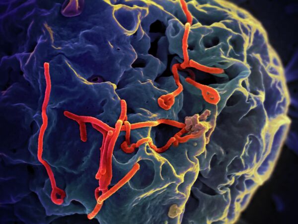 Вирус Эбола под микроскопом. Архивное фото - Sputnik Кыргызстан