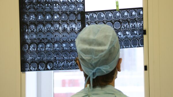 Врач смотрит на рентген снимки мозга. Архивное фото - Sputnik Кыргызстан