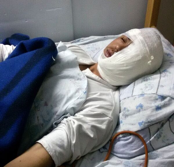 Избитый солдат Абытбек уулу Мамарасул в военном госпитале. - Sputnik Кыргызстан