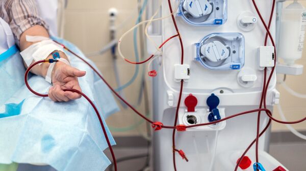 Пациент во время процедуры очистки крови на аппарате Искусственная почка в медицинском частном учреждении. Архивное фото - Sputnik Кыргызстан