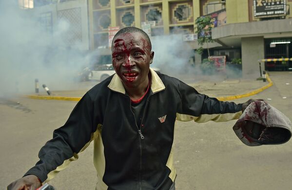 Кениянын борбору Найроби шаарында оппозиция менен полициянын кагылышуусунан жаракат алган киши - Sputnik Кыргызстан