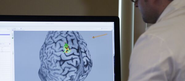Снимок мозга на мониторе - Sputnik Кыргызстан