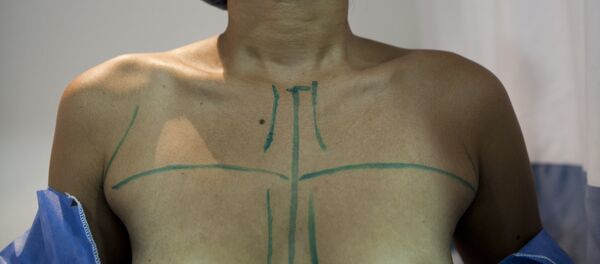 Девушка перед операцией на груди. Архивное фото - Sputnik Кыргызстан