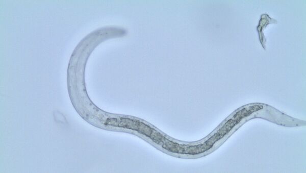 Аскарида — паразитический круглый червь, вызывающий аскаридоз. Архивное фото - Sputnik Кыргызстан