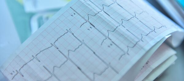 Кардиограмма сердечного ритма. Архивное фото - Sputnik Кыргызстан