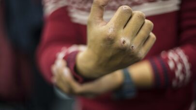 Случаи применения физической силы в КР