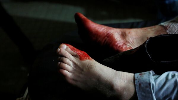 Ноги мужчины в крови. Архивное фото - Sputnik Кыргызстан