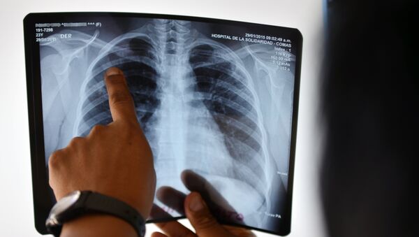 Врач смотрит рентген снимок пациента. Архивное фото - Sputnik Кыргызстан