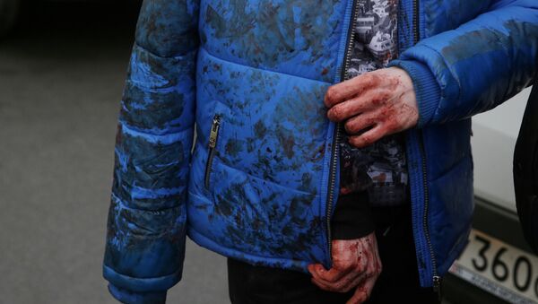 Мужчина в окровавленной куртке. Архивное фото - Sputnik Кыргызстан