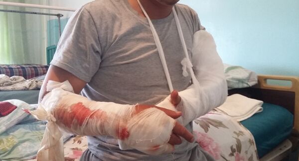 Мурат Данияров получил открытый перелом руки и растяжение предплечья - Sputnik Кыргызстан