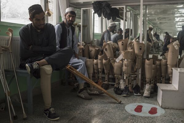 Кабулдагы (Афганистан) ортопедиялык клиниканын бейтаптары - Sputnik Кыргызстан