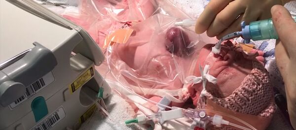 Улуу Британияда жүрөгү сыртында жайгашкан кыз төрөлдү. Видео - Sputnik Кыргызстан