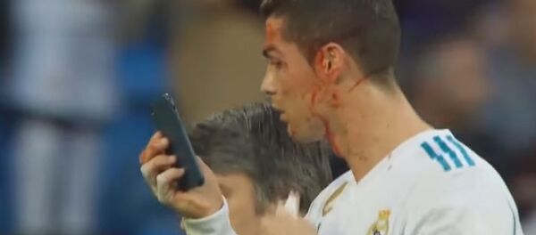 Роналду увидел свое окровавленное лицо и расстроился — видео Роналду увидел свое окровавленное лицо и расстроился — видео - Sputnik Кыргызстан