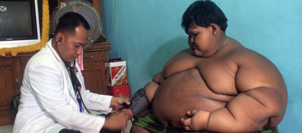 Дүйнөдөгү эң семиз бала, индонезиялык 12 жаштагы Арья Пермана - Sputnik Кыргызстан