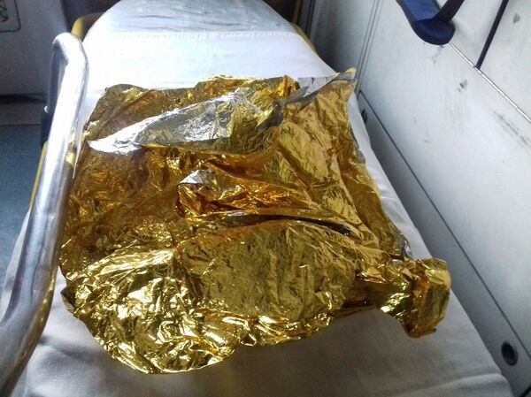 Фольга для согревания замерзших пациентов - Sputnik Кыргызстан