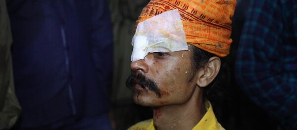 В Индии люди обращались в больницу после фестиваля метания камней - Sputnik Кыргызстан