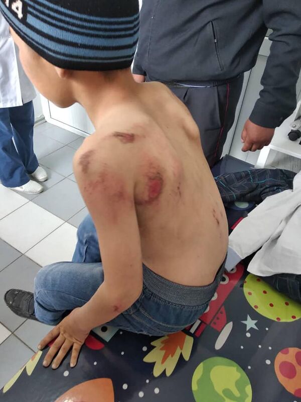 Бишкекте мигранттын уулун таякеси сабап, унаасы менен сүйрөткөн - Sputnik Кыргызстан