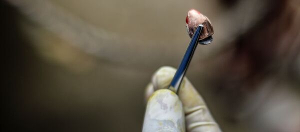 Врач показывает пулю. Архивное фото - Sputnik Кыргызстан