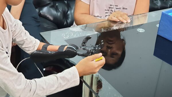 Бионический протез руки для 12-летней кыргызстанки - Sputnik Кыргызстан