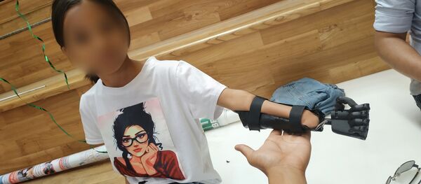 Биопротез управляемая силой мысли разработанная хирургами из Кыргызстана - Sputnik Кыргызстан